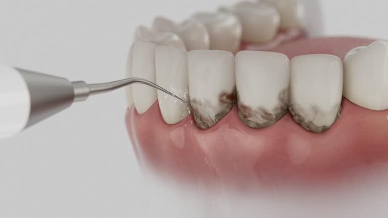 Reliable Dental contractor in Lathrop, MO by Smile Center Dentistry